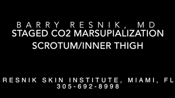 Staged CO2 Marsupialization Scrotum / Inner Thigh